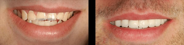 ^D19253067B6Cc1Db055F267B092537D24D8C81A305E192A444^Pimgpsh Fullsize Distr