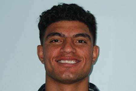 Initial full view showing traumatic dental injury