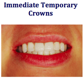 After: Rapid Repair of Two Fractured Anterior Teeth