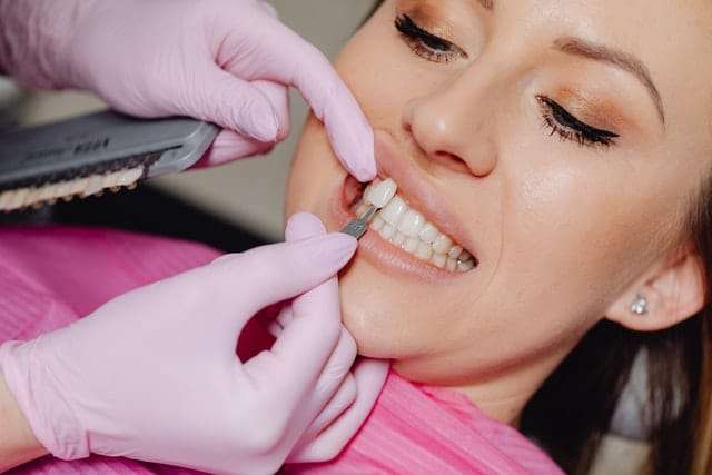 Most Common Misconceptions About Veneers