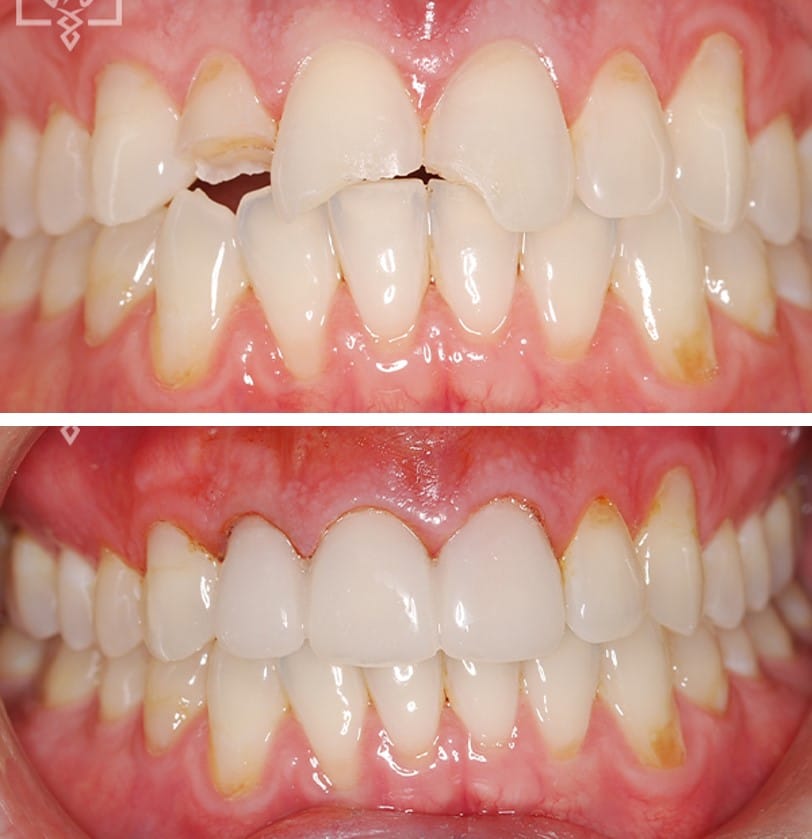 Emergency Aesthetic Repair 1892 1893