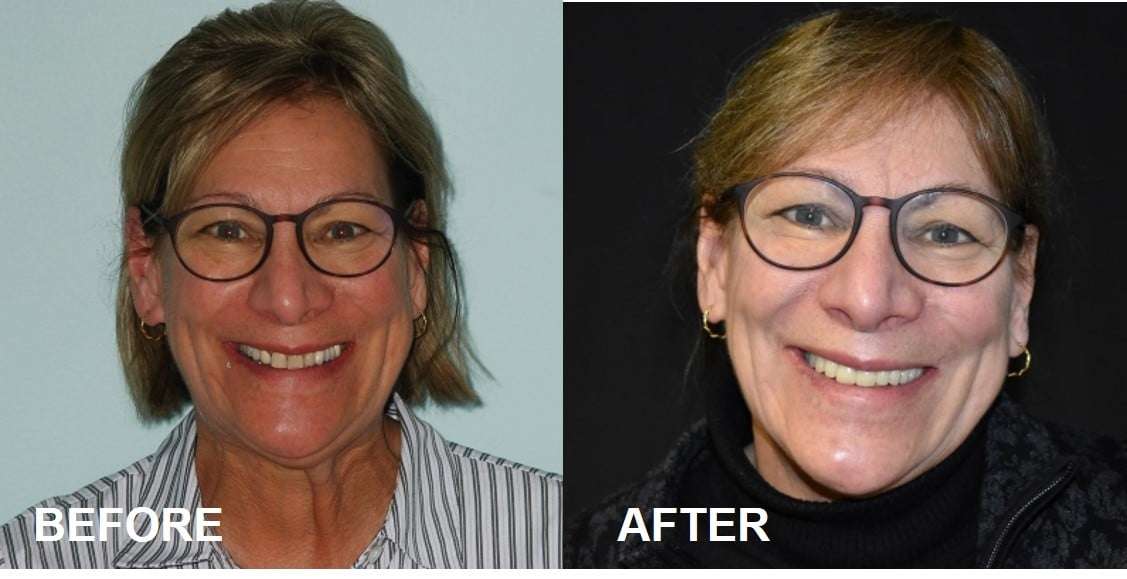 Benefits of a Cosmetic Smile Makeover With Dental Sedation
