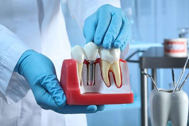 How Painful Is a Dental Implant?
