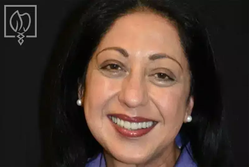 Patient smile result