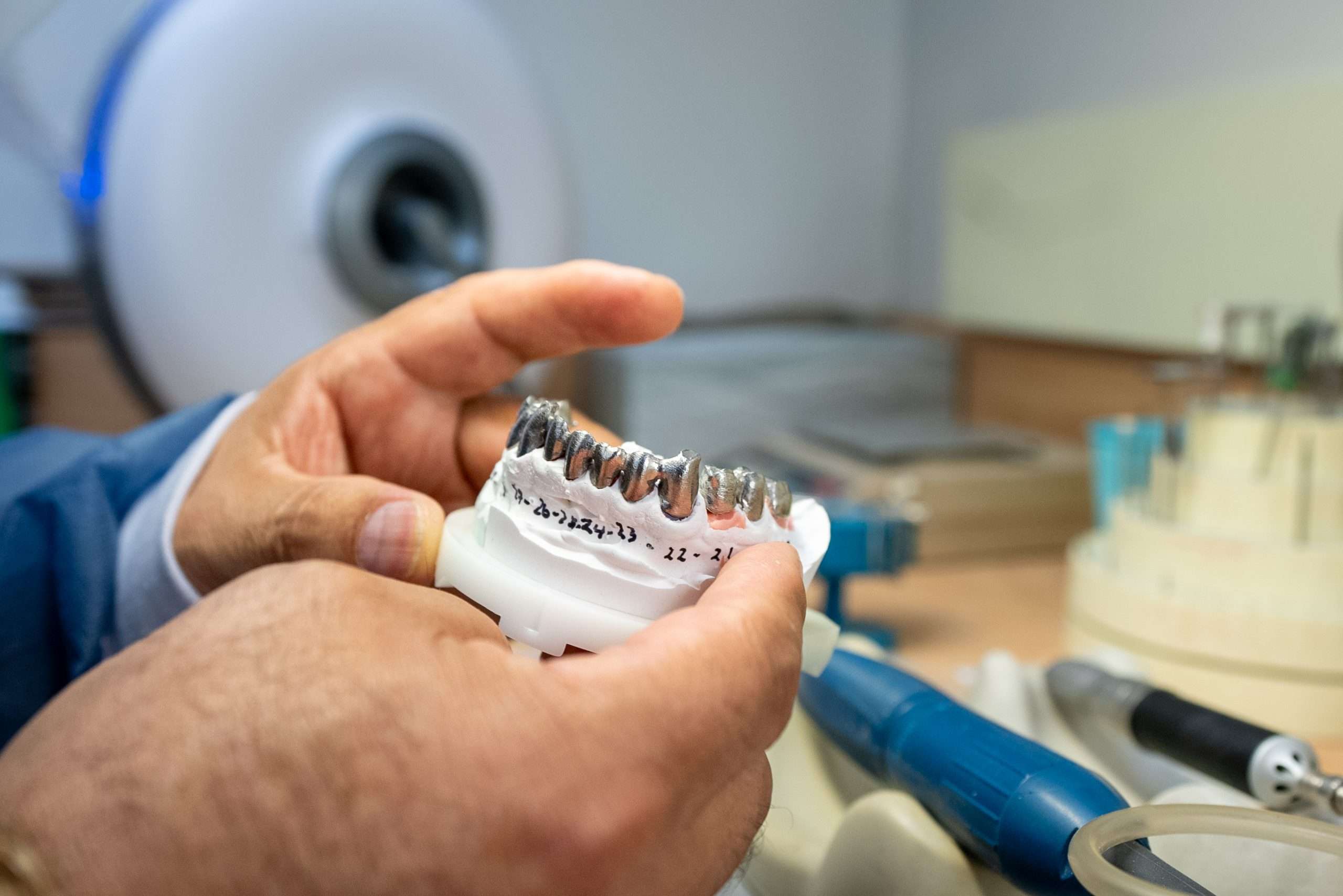 A person holds a dental mold with several metal dental implants fitted on it, showcasing all on 4 implants. Dental tools and equipment are visible on the table in the background, highlighting advanced cosmetic dentistry techniques.