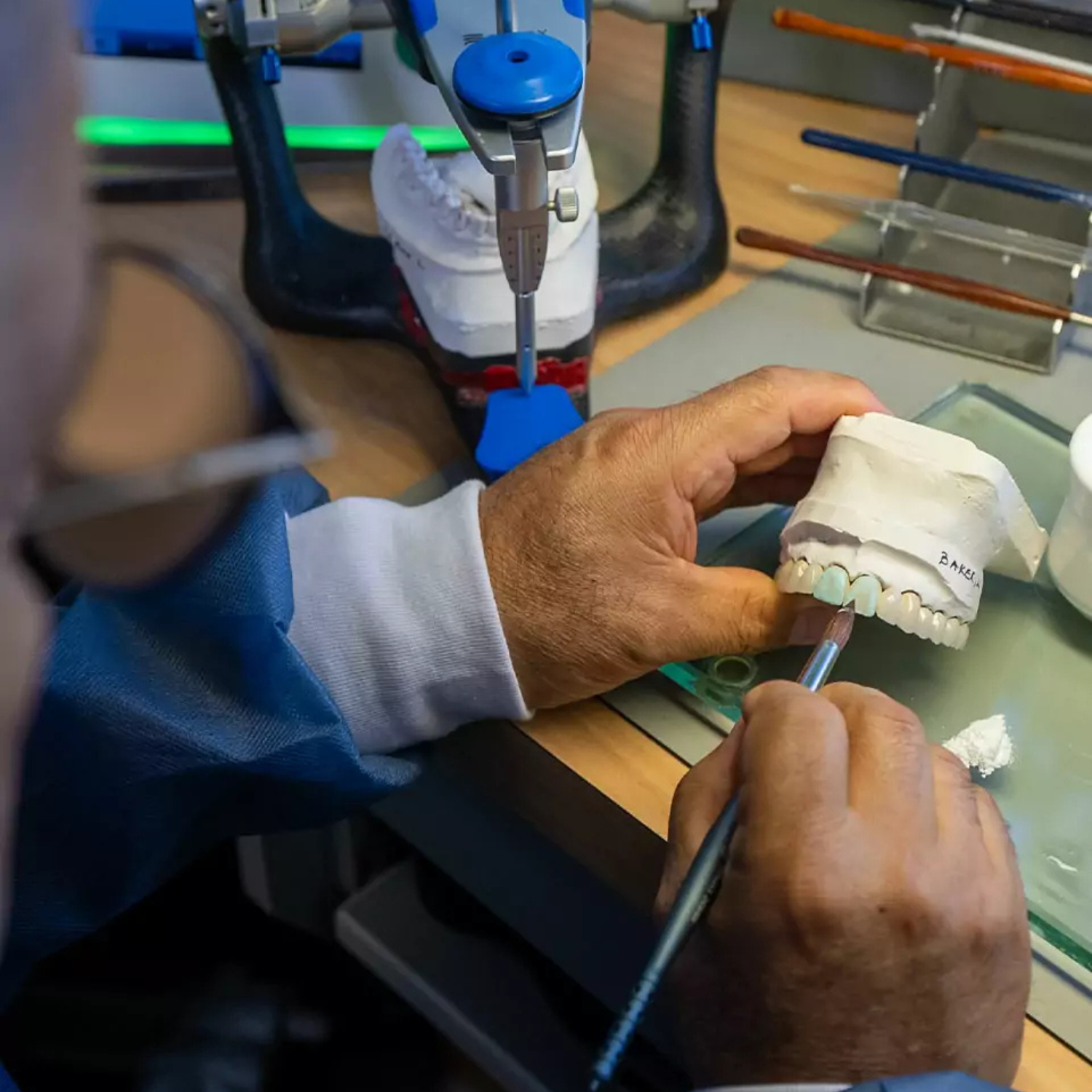 dental crowns dental crowns