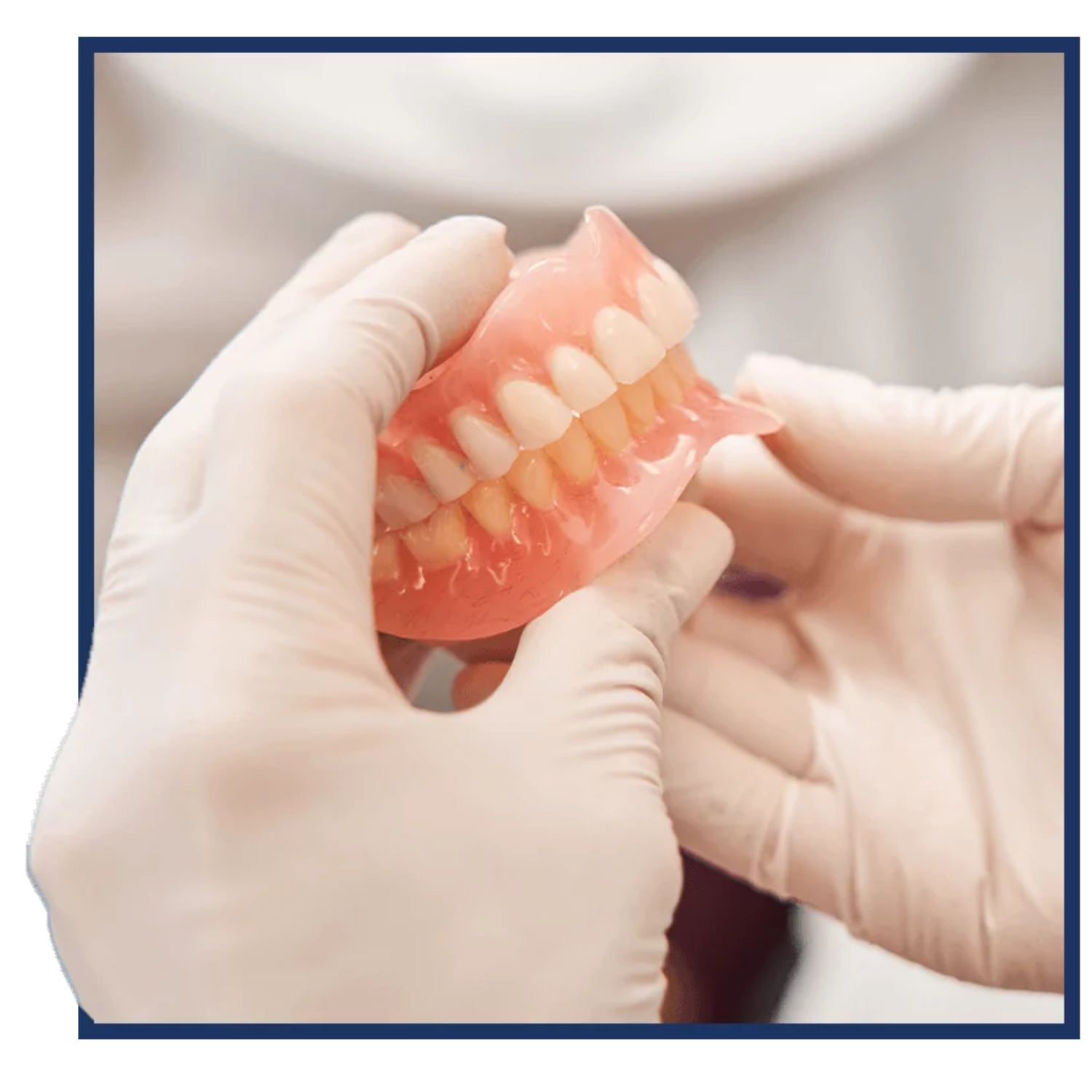 Custom-crafted full denture prosthesis