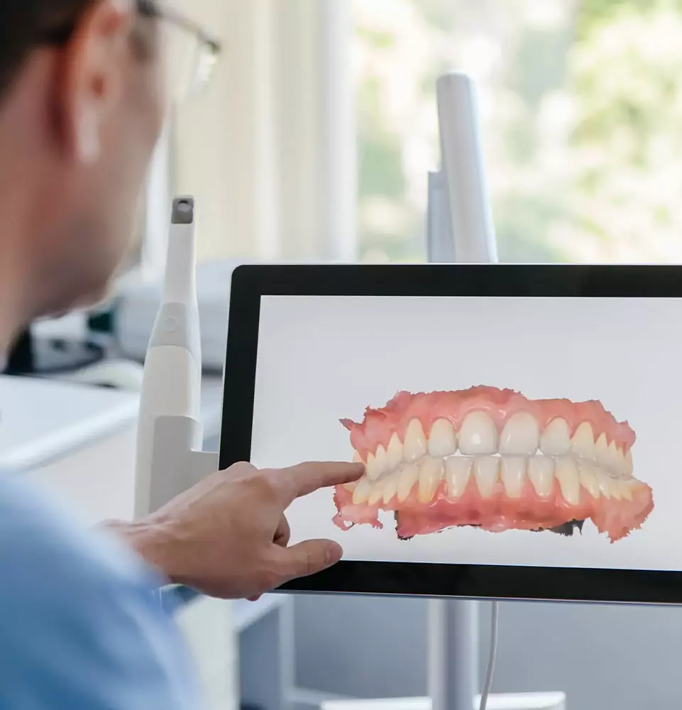 Smile makeover planning