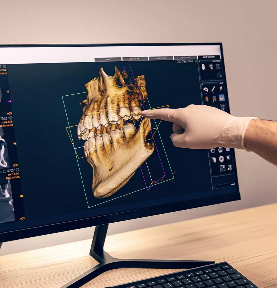 3D dental scan for full mouth reconstruction