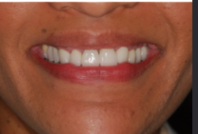 She Now Smiles Without Being Self-Conscious