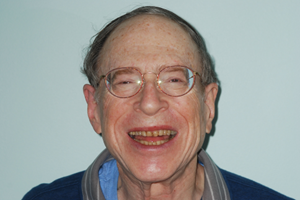 Severely worn dentition making him self-conscious