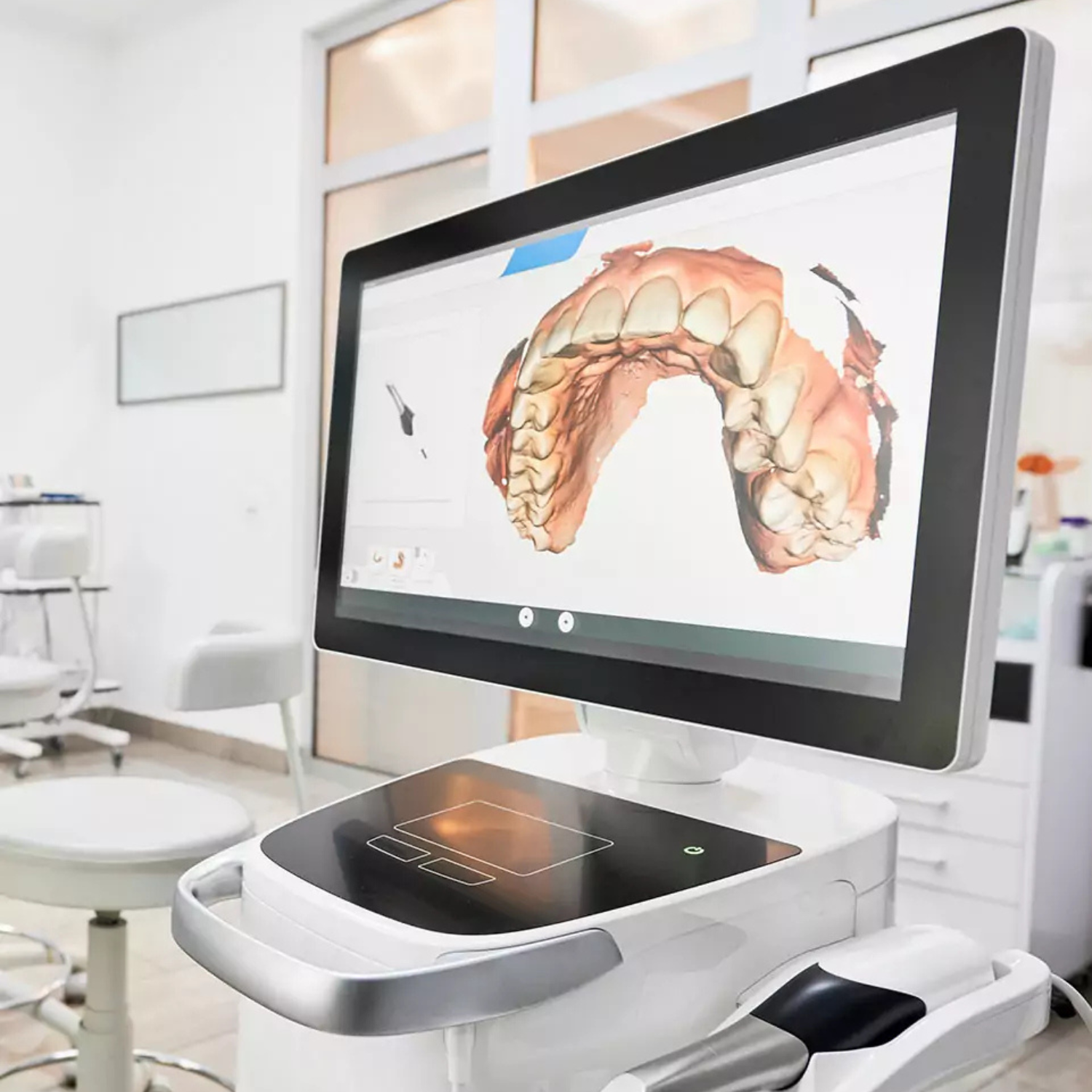 Patient smile transformation with custom dental restorations