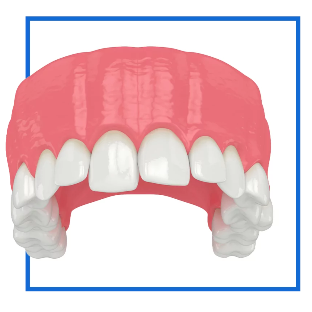Patient results after removable prosthodontic treatment