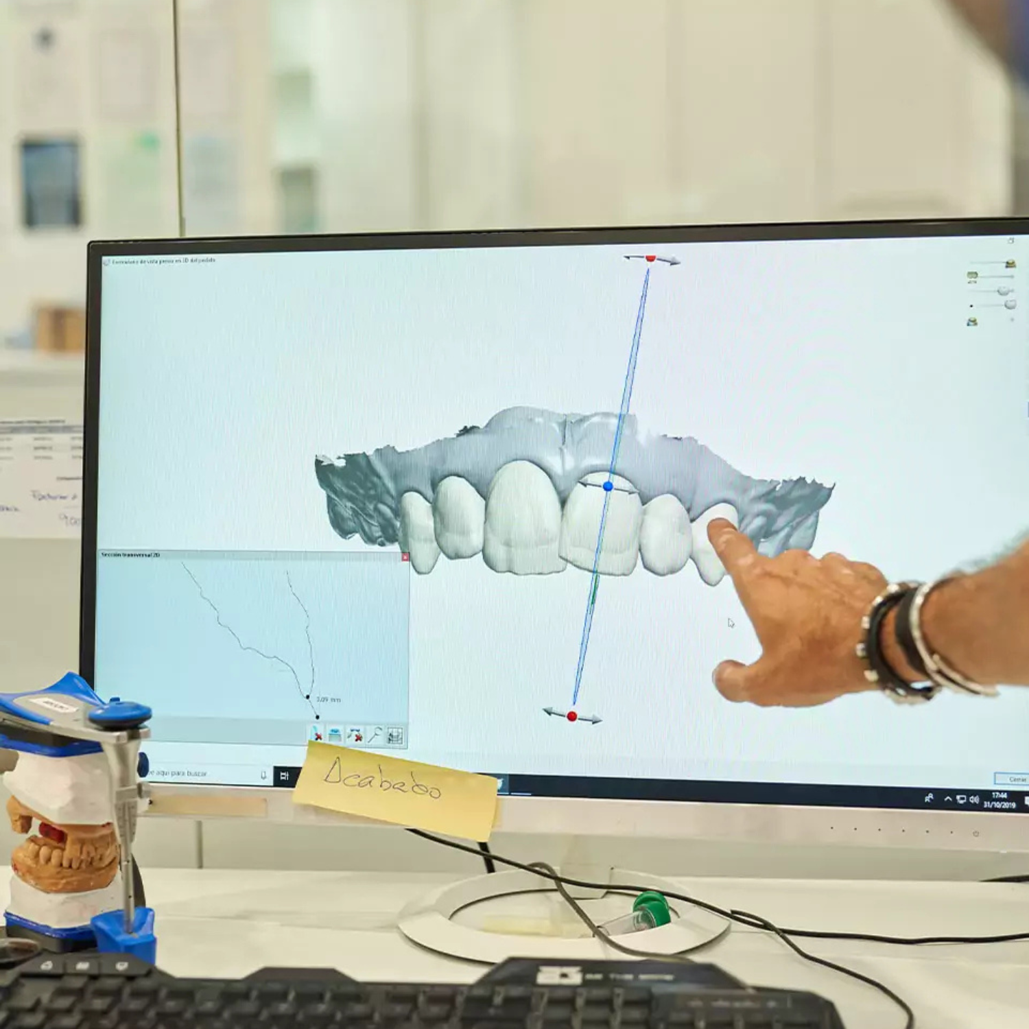 Before and after results of a cosmetic smile makeover