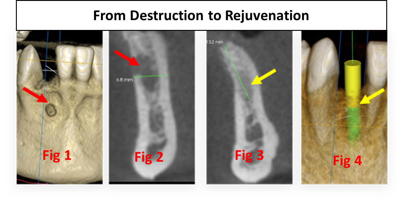 Composite case image showing all figures referenced in the case study