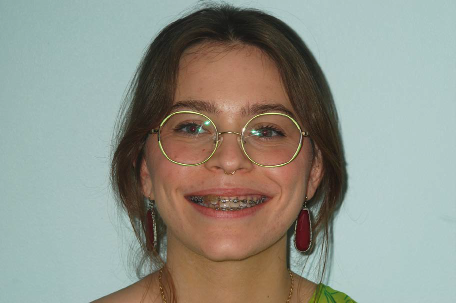 Before Reconstruction