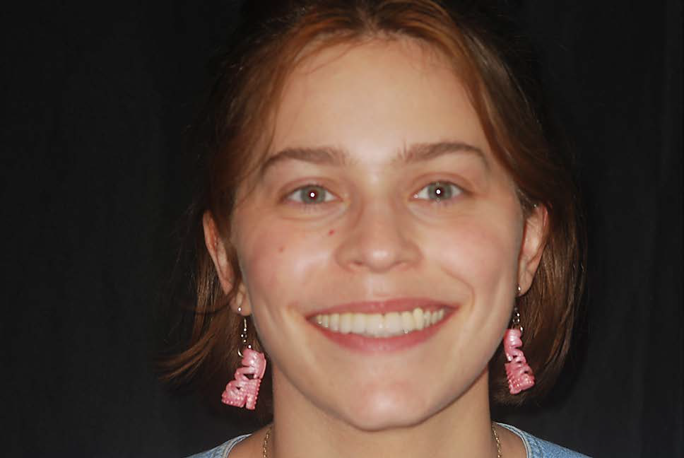 After Reconstruction