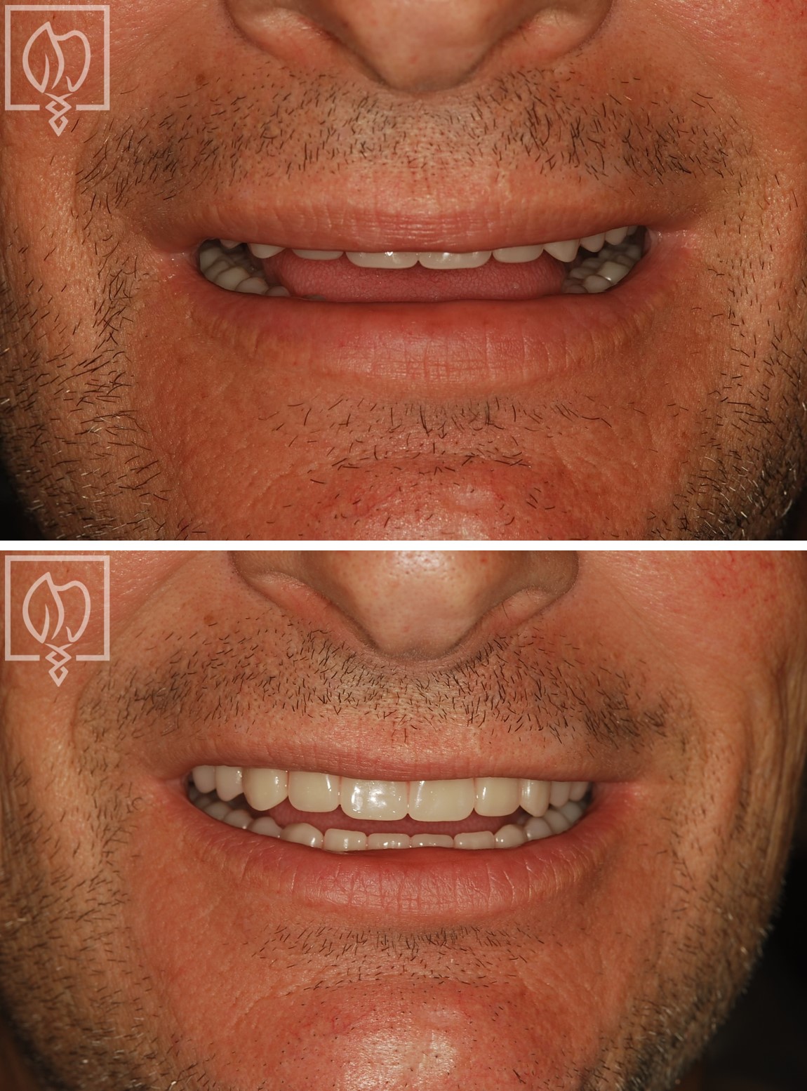 Documented smile view following treatment in this case.