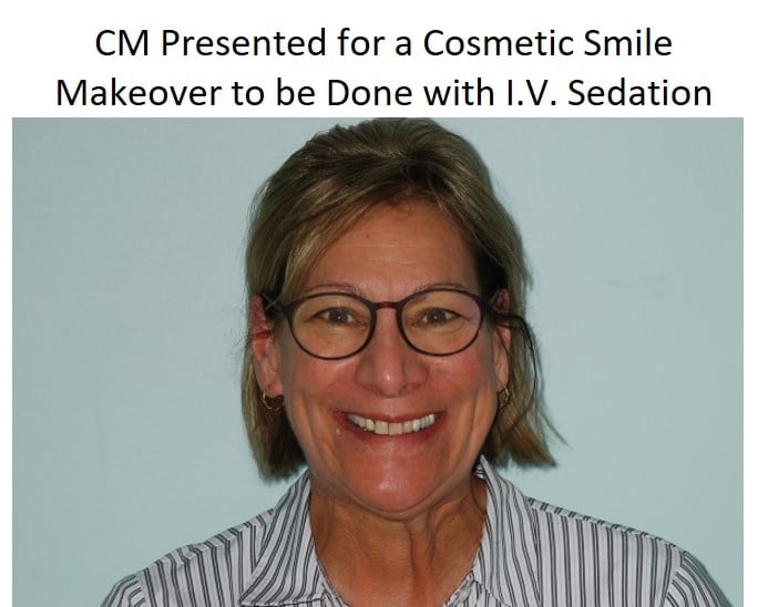 Patient smile before cosmetic makeover with sedation